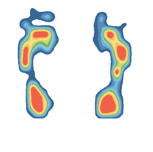Analyse des pressions plantaires